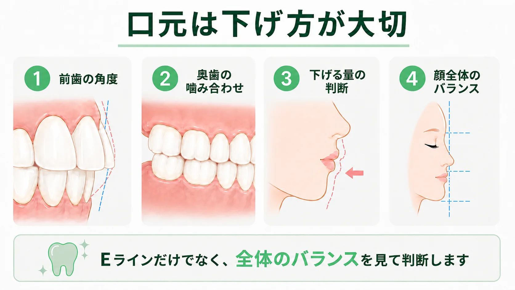 口元を下げる治療で前歯の角度・奥歯の噛み合わせ・下げる量の判断・顔全体のバランスを確認することを示す図