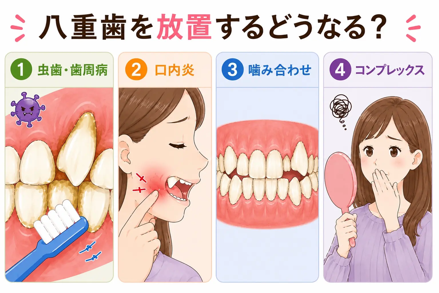 八重歯を放置することで起こりうるリスクのイメージ図
