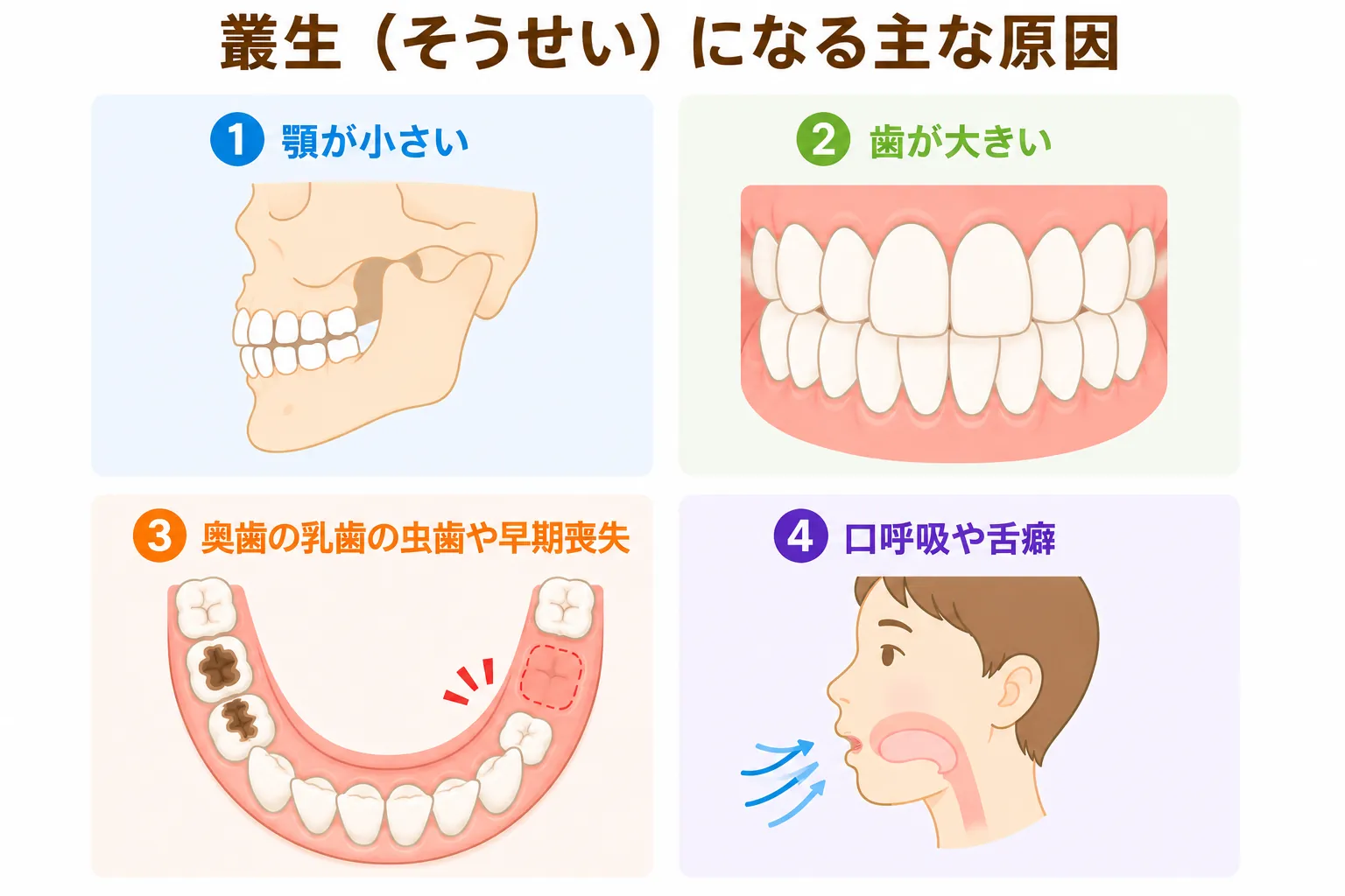 叢生の主な原因