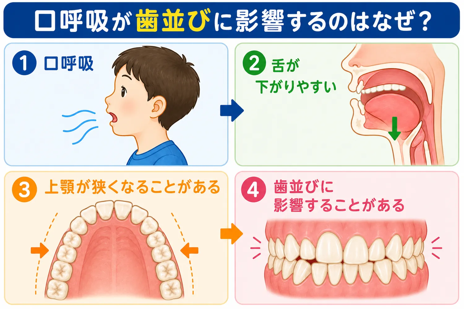口呼吸が歯並びに影響する仕組み