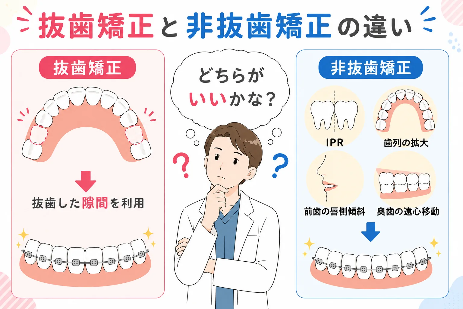抜歯矯正と非抜歯矯正の違いを説明したイラスト